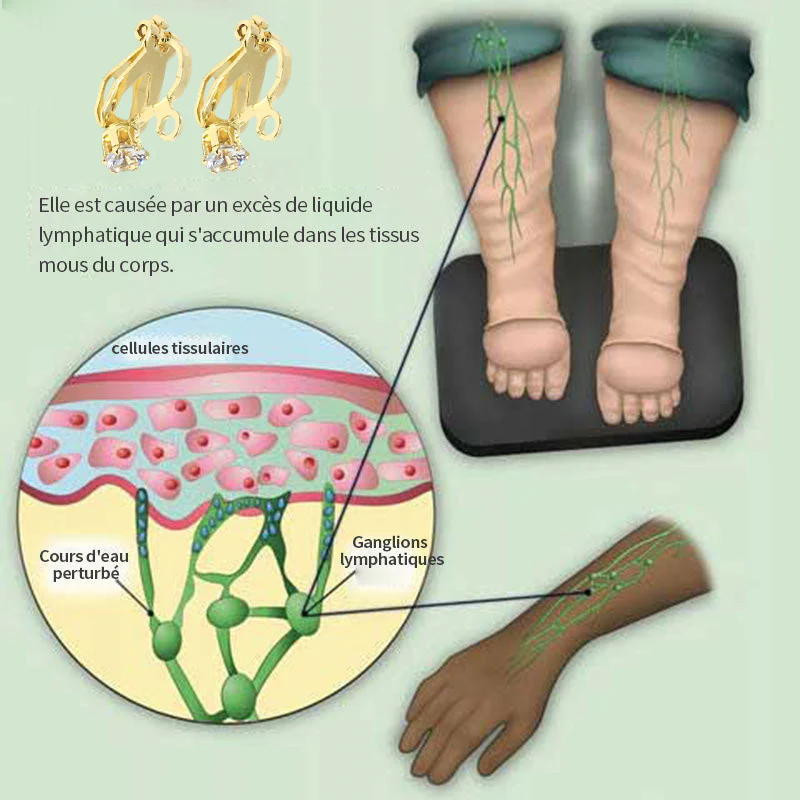 (🌟DERNIER JOUR – 80 % DE RÉDUCTION🌟)  Boucles d'oreilles CZTICLE® Lymphvity MagneTherapy au germanium - Image 6