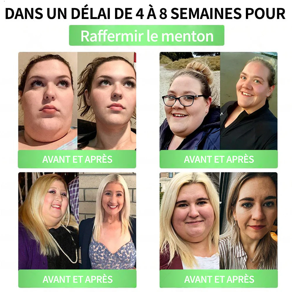 💖𝑷𝒉𝒂𝒓𝒎𝒂𝒄𝒊𝒆 𝑶𝒇𝒇𝒊𝒄𝒊𝒆𝒍𝒍𝒆💖 | 🇫🇷 Purelora® Moringa · Berbérine Patch 10-en-1 aux Nano-Micro-Aiguilles et Cryo-Gel ✅ Soutien Cryo-Métabolique : Cristallise les graisses, raffermit la peau et élimine l'œdème instantanément. - Image 10