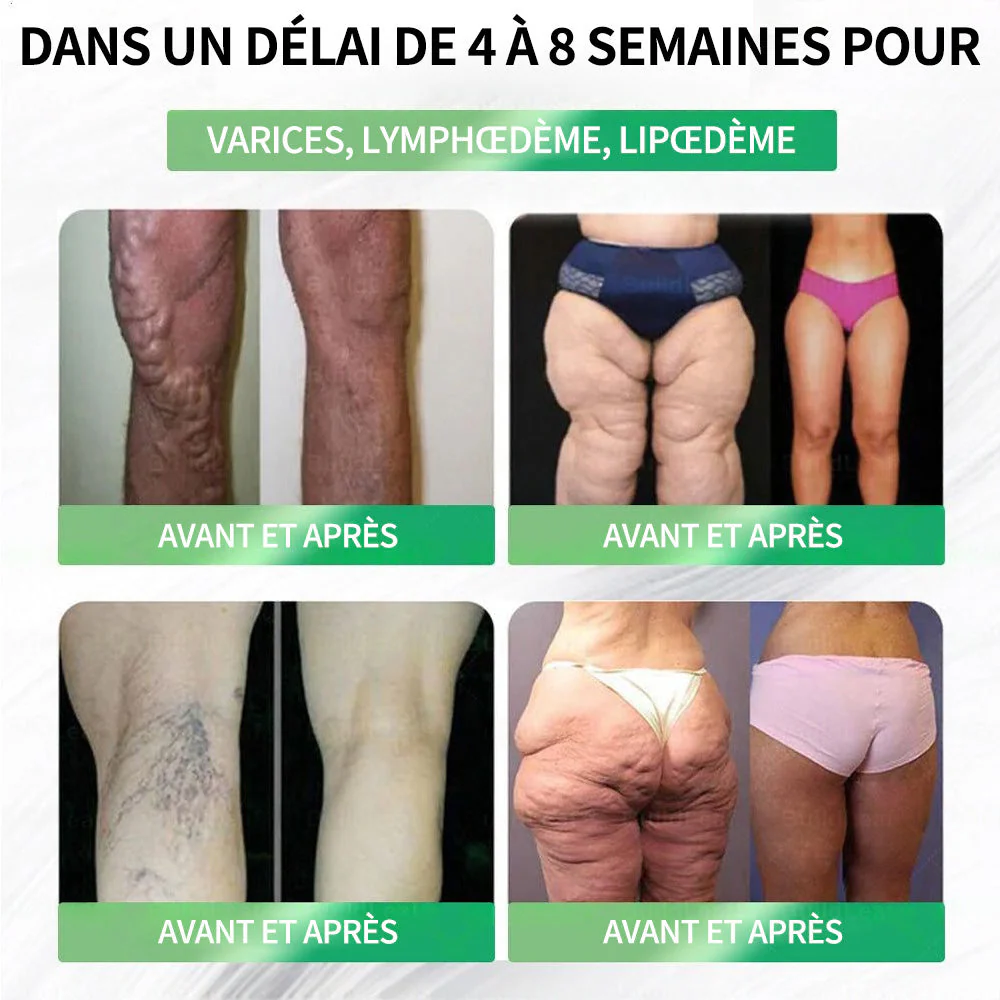 💖𝑷𝒉𝒂𝒓𝒎𝒂𝒄𝒊𝒆 𝑶𝒇𝒇𝒊𝒄𝒊𝒆𝒍𝒍𝒆💖 | Purelora® Moringa · Berbérine Patch 10-en-1 aux Nano-Micro-Aiguilles et Cryo-Gel ✅ Soutien Cryo-Métabolique : Cristallise les graisses, raffermit la peau et élimine l'œdème instantanément. - Image 12