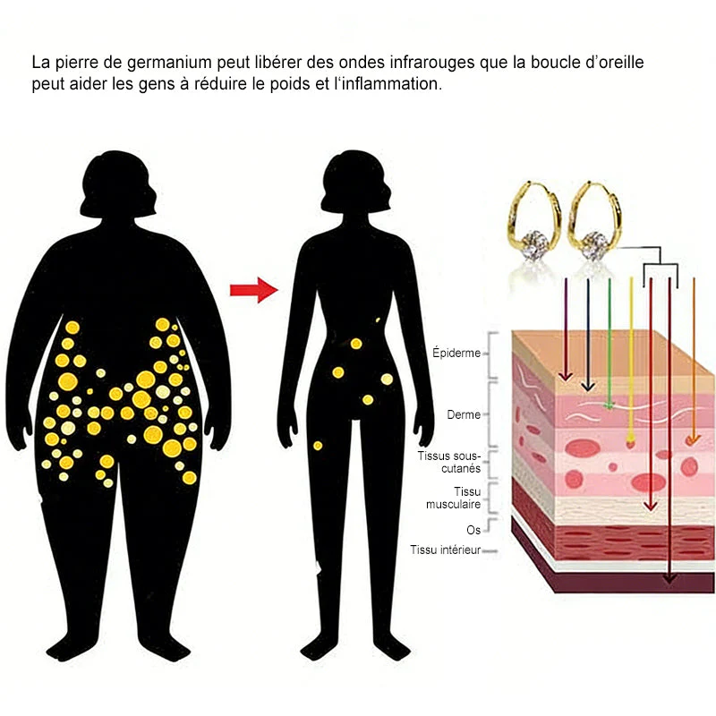 (🔥DERNIER JOUR DE PROMO - 80 % DE RÉDUCTION🔥) 🎉 CZTICLE® Boucles d'oreilles Lymphvity MagneTherapy au germanium(Une fois par jour, changements visibles en 7 jours) sensation plus légère, se sentir mieux au quotidien, plus de confiance dans ses vêtements🍃 - Image 10