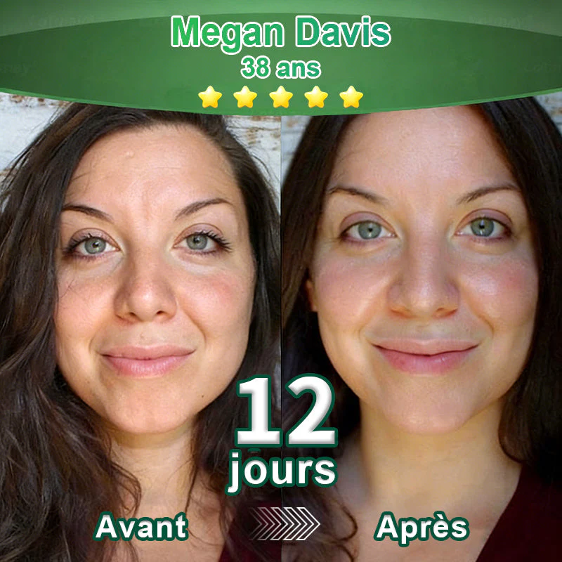 💖 Changez de l’intérieur vers l’extérieur | ✨ Purelora® Sérum Activateur EGF & Peptides de Cuivre dérivés de cellules souches (Active intensément le renouvellement cutané pour une peau plus ferme et plus lisse) - Image 5
