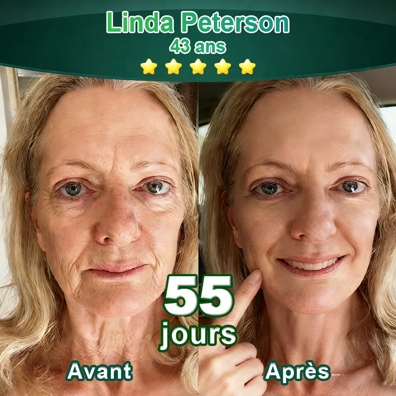 💖 Changez de l’intérieur vers l’extérieur | ✨ Purelora® Sérum Activateur EGF & Peptides de Cuivre dérivés de cellules souches (Active intensément le renouvellement cutané pour une peau plus ferme et plus lisse) - Image 9