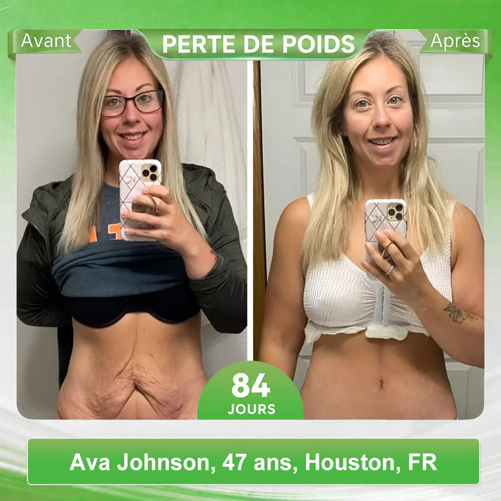 🔥 Patch Minceur Curalona® aux Nano-aiguilles de Phosphore Noir — Formule 12-en-1 (avec Berbérine + NMN + Vinaigre de cidre) | Stimule la combustion des graisses et stabilise la glycémie | Observez la transformation en seulement 7 jours - Image 2